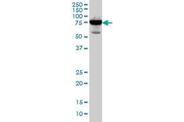 Radixin Antikörper  (AA 1-583)