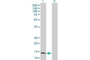 Western Blot analysis of ZNF44 expression in transfected 293T cell line by ZNF44 MaxPab polyclonal antibody. (Zinc Finger Protein 44 Antikörper  (AA 1-154))