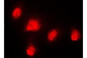 Immunofluorescent analysis of c-RAF staining in HeLa cells.