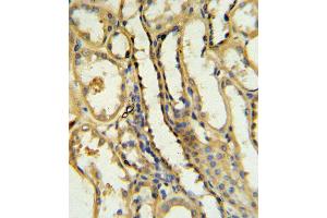 TRAP Antibody IHC analysis in formalin fixed and paraffin embedded human kidney tissue followed by peroxidase conjugation of the secondary antibody and DAB staining. (CD40 Ligand Antikörper  (N-Term))
