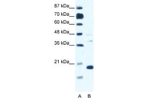 WB Suggested Anti-CACNG1 Antibody Titration:  0. (CACNG1 Antikörper  (N-Term))