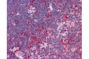 Anti-TNFRSF10A / DR4 antibody IHC of human thymus. (TNFRSF10A Antikörper)