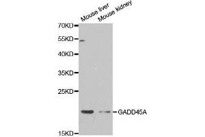 Western blot analysis of extracts of various cell lines, using GADD45A antibody. (GADD45A Antikörper  (AA 1-165))