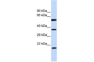 WB Suggested Anti-NT5DC1 Antibody Titration: 0.