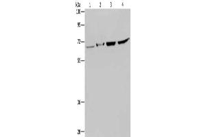 Gel: 8 % SDS-PAGE, Lysate: 40 μg, Lane 1-4: Human testis tissue, mouse liver tissue, Hela cells, 293T cells, Primary antibody: ABIN7129681(HACL1 Antibody) at dilution 1/200, Secondary antibody: Goat anti rabbit IgG at 1/8000 dilution, Exposure time: 5 minutes (HACL1 Antikörper)
