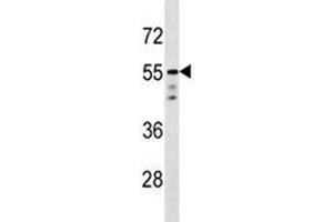 AKT1 antibody western blot analysis in T47D lysate