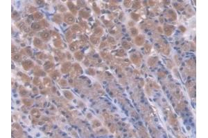 Immunohistochemistry (IHC) image for anti-CD7 (CD7) (AA 23-128) antibody (ABIN7444427)