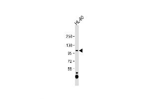 Western Blot at 1:1000 dilution + HL-60 whole cell lysate Lysates/proteins at 20 ug per lane. (NAA25 Antikörper  (AA 720-748))