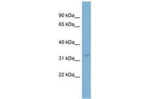 Image no. 1 for anti-Solute Carrier Family 25 (Carnitine/acylcarnitine Translocase), Member 20 (SLC25A20) (AA 143-192) antibody (ABIN6742017)
