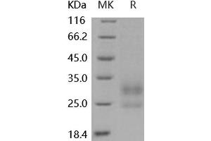 Western Blotting (WB) image for Lymphocyte Antigen 86 (LY86) protein (His tag) (ABIN7320457)