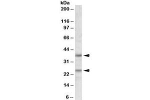 Western blot testing of human cerebellum lysate with Podoplanin antibody at 1ug/ml. (Podoplanin Antikörper)