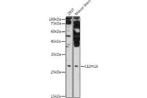 Western blot analysis of extracts of various cell lines, using CLDN16 antibody (ABIN6133646, ABIN6138679, ABIN6138680 and ABIN6225195) at 1:500 dilution. (Claudin 16 Antikörper  (AA 50-150))