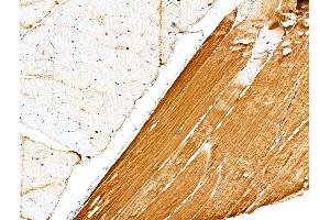ABIN6263820 and ABIN6276785 at 1/100 staining Rat muscle tissue by IHC-P. (OLR1 Antikörper  (N-Term))