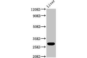 Western Blot Positive WB detected in: Rat liver tissue All lanes: RAB26 antibody at 5. (RAB26 Antikörper  (AA 1-58))