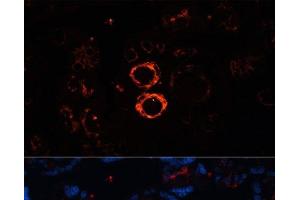 Immunofluorescence analysis of Human placenta cells using MYH11 Polyclonal Antibody at dilution of 1:100. (MYH11 Antikörper)