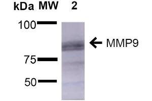 Western Blotting (WB) image for anti-Matrix Metallopeptidase 9 (Gelatinase B, 92kDa Gelatinase, 92kDa Type IV Collagenase) (MMP9) (AA 1-708) antibody (PE) (ABIN2482813)