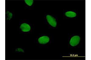 Immunofluorescence of purified MaxPab antibody to CHD2 on HeLa cell. (CHD2 Antikörper  (AA 1-501))