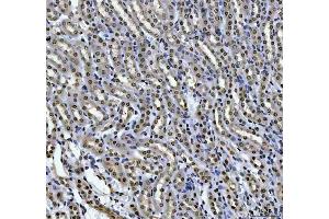 IHC analysis of HOXC4 using anti-HOXC4 antibody (ABIN7603059). (HOXC4 Antikörper  (Middle Region))