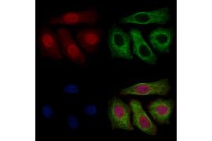 ABIN7094791 and ABIN7098842 staining Hela cells by IF/ICC. (UBA1 Antikörper  (Internal Region))