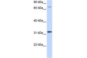 ZNF799 anticorps  (AA 261-310)