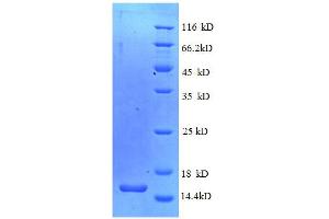 SDS-PAGE (SDS) image for Myelin Protein Zero (MPZ) (AA 30-153) protein (His tag) (ABIN7478947)