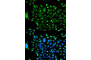 Immunofluorescence analysis of U2OS cells using NCOR1 antibody (ABIN5974239).