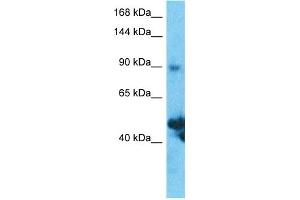 Host:  Rabbit  Target Name:  SLC39A10  Sample Type:  Thymus Tumor lysates  Antibody Dilution:  1. (SLC39A10 Antikörper  (N-Term))