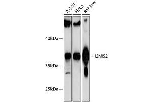Western blot analysis of extracts of various cell lines, using LIMS2 antibody (ABIN6132166, ABIN6143236, ABIN6143237 and ABIN6217146) at 1:1000 dilution. (LIMS2 Antikörper  (AA 1-341))