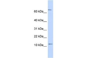 WB Suggested Anti-TRA16 Antibody Titration: 0. (NR2C2AP Antikörper  (N-Term))