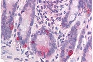 Immunohistochemistry (IHC) image for anti-Wingless-Type MMTV Integration Site Family, Member 1 (WNT1) (Internal Region) antibody (ABIN1049465)