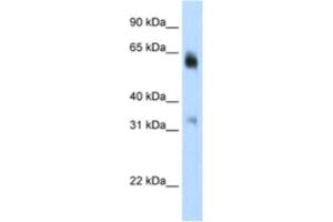 Western Blotting (WB) image for anti-Lysine (K)-Specific Demethylase 4D (KDM4D) antibody (ABIN2461887) (JMJD2D Antikörper)