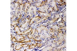 IHC analysis of AMFR using anti-AMFR antibody (ABIN4886455). (AMFR Antikörper  (AA 553-643))