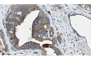 ABIN6274964 at 1/100 staining Human prostate tissue by IHC-P. (CBR1 Antikörper  (C-Term))