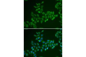 Immunofluorescence analysis of HeLa cell using CRAT antibody. (CRAT Antikörper)