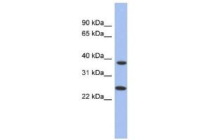 WB Suggested Anti-MTRF1L Antibody Titration: 0. (MTRF1L Antikörper  (N-Term))
