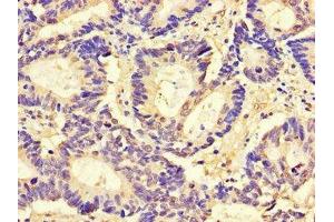 Immunohistochemistry (IHC) image for anti-CD9 (CD9) (AA 112-195) antibody (ABIN7147190)