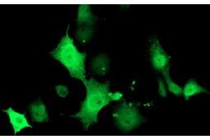 Anti-TMOD1 mouse monoclonal antibody (ABIN2454778) immunofluorescent staining of COS7 cells transiently transfected by pCMV6-ENTRY TMOD1 (RC201134). (Tropomodulin 1 Antikörper)