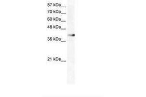 Image no. 1 for anti-Zinc Finger Protein 556 (ZNF556) (AA 322-371) antibody (ABIN202562) (ZNF556 Antikörper  (AA 322-371))