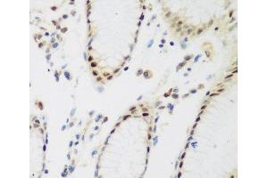 Immunohistochemistry of paraffin-embedded Human stomach using PPAN Polyclonal Antibody at dilution of 1:200 (40x lens).