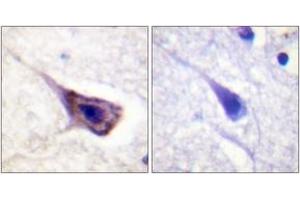 Immunohistochemistry analysis of paraffin-embedded human brain tissue, using BAD (Ab-134) Antibody. (BAD Antikörper  (AA 100-149))