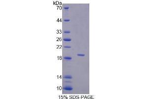 SDS-PAGE (SDS) image for serpin Peptidase Inhibitor, Clade A (Alpha-1 Antiproteinase, Antitrypsin), Member 6 (SERPINA6) (AA 218-378) protein (His tag) (ABIN1170235)
