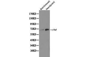 Western Blotting (WB) image for anti-V-Raf-1 Murine Leukemia Viral Oncogene Homolog 1 (RAF1) (C-Term) antibody (ABIN1874535) (RAF1 Antikörper  (C-Term))