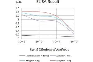 Black line: Control Antigen (100 ng),Purple line: Antigen (10 ng), Blue line: Antigen (50 ng), Red line:Antigen (100 ng) (DR3/LARD Antikörper)