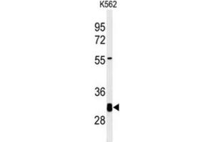 Western Blotting (WB) image for anti-Potassium Channel Tetramerisation Domain Containing 7 (KCTD7) antibody (ABIN3002217) (KCTD7 Antikörper)