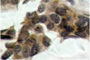 Image no. 2 for anti-Nuclear Factor of kappa Light Polypeptide Gene Enhancer in B-Cells Inhibitor, alpha (NFKBIA) (pSer32), (pSer36) antibody (ABIN318052) (NFKBIA Antikörper  (pSer32, pSer36))