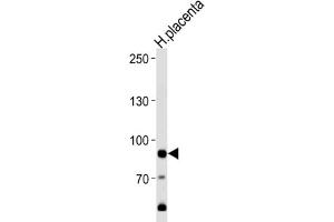 Western Blotting (WB) image for anti-Adenosine Monophosphate Deaminase 3 (AMPD3) antibody (ABIN3003542) (AMPD3 Antikörper)