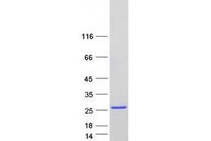 Western Blotting (WB) image for Prkr Interacting Protein 1 (IL11 Inducible) (PRKRIP1) protein (Myc-DYKDDDDK Tag) (ABIN2729645)