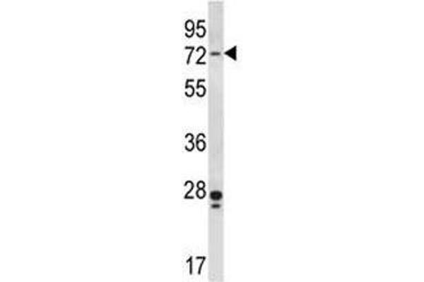 PAK4 Antikörper  (AA 187-216)