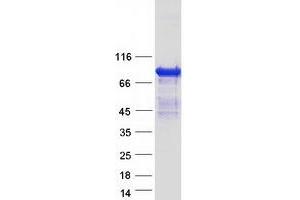 Validation with Western Blot (ARHGAP24 Protein (Transcript Variant 1) (Myc-DYKDDDDK Tag))