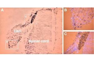 Immunohistochemistry (IHC) image for anti-Sodium Channel, Voltage-Gated, Type XI, alpha Subunit (SCN11A) (AA 1748-1765), (Intracellular) antibody (ABIN7043657)